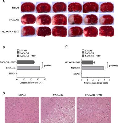 Modulation of gut microbiota alleviates cerebral ischemia/reperfusion injury in rats by inhibiting M1 polarization of microglia